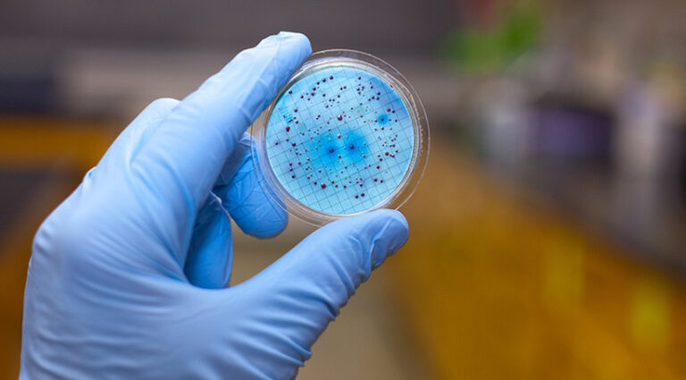 The Ticking Clock of Resistance: Antimicrobial Threats