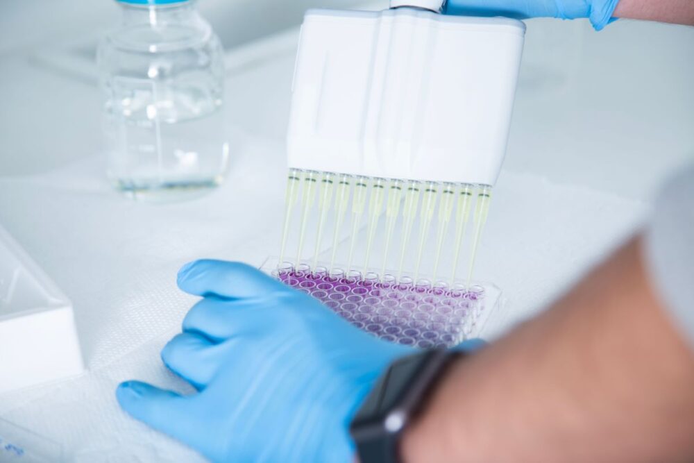 Lab technician analyzing a molecular diagnostic test strip for GI pathogen detection