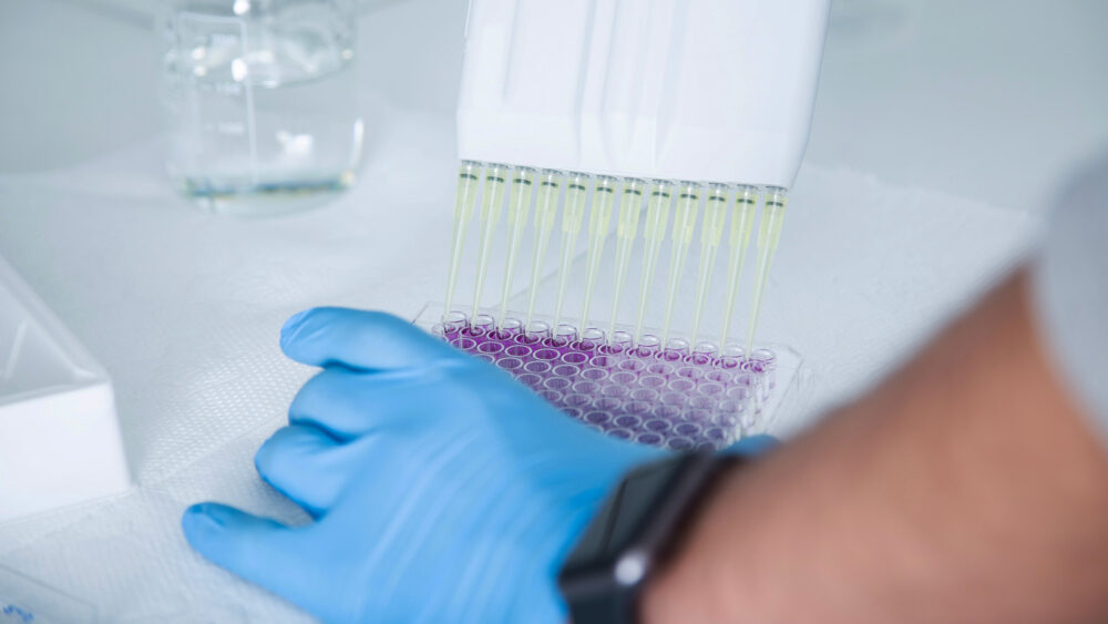 Laboratory technician analyzing a molecular diagnostic test strip
