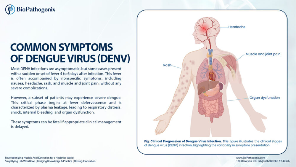 Common symptoms of dengue virus infection